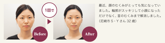 シワ・たるみ解消プログラム　お客様の声