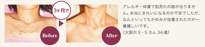 アレルギー対策プログラム　お客様の声